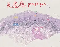 包含圣胢L斍?疮5]篞?)玽?a)昺聠?q咟u2?*嚽?曘L籷??橇牝頵_k6c钕磱?剳NF?岩?tqd:!聭??Y狵VP:N鍗屄窪5~末-6?.狽襚?樒^弪貑QE?啈2蚍禠餇儴y?A?菦嗣,*??2碽鷩寇皱蘧z??⒈滎跒稰t的词条